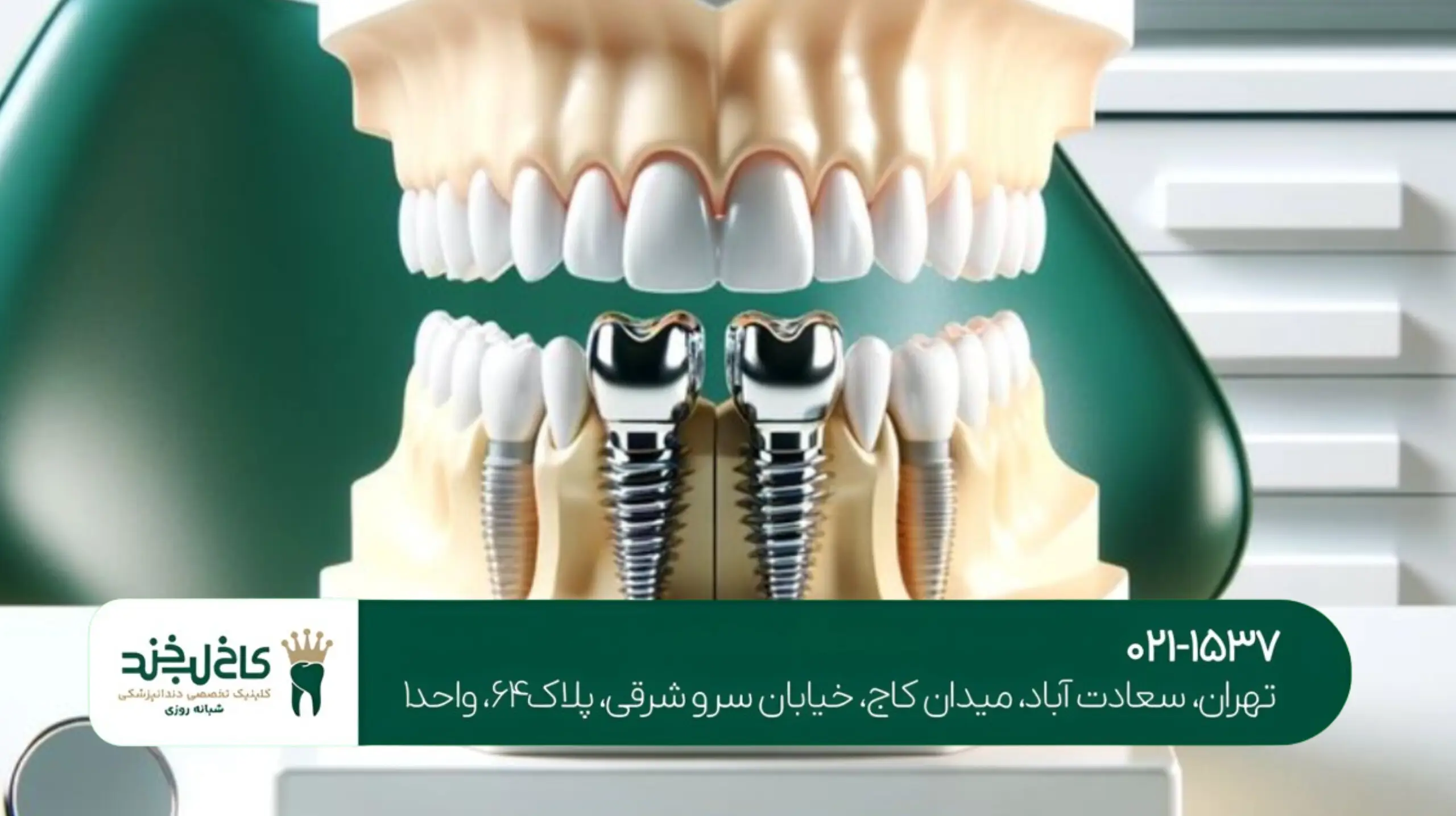 کلینیک ایمپلنت دیجیتال