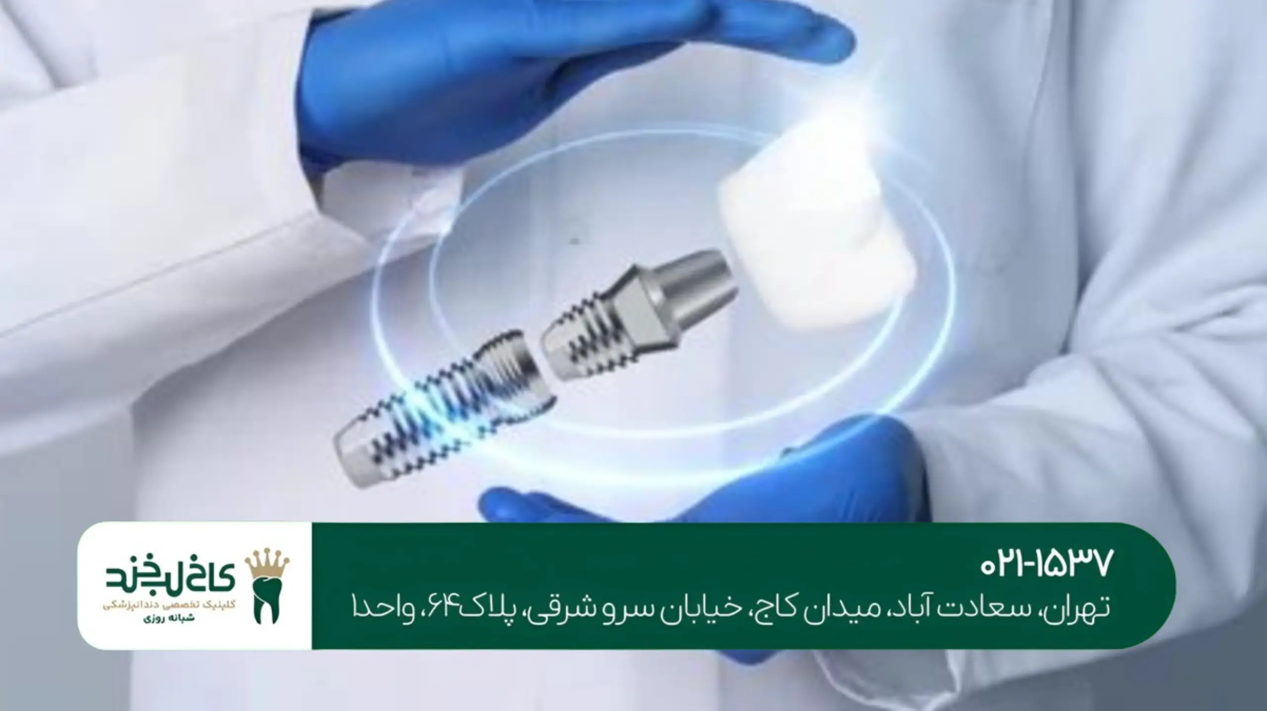 کلینیک ایمپلنت دیجیتال