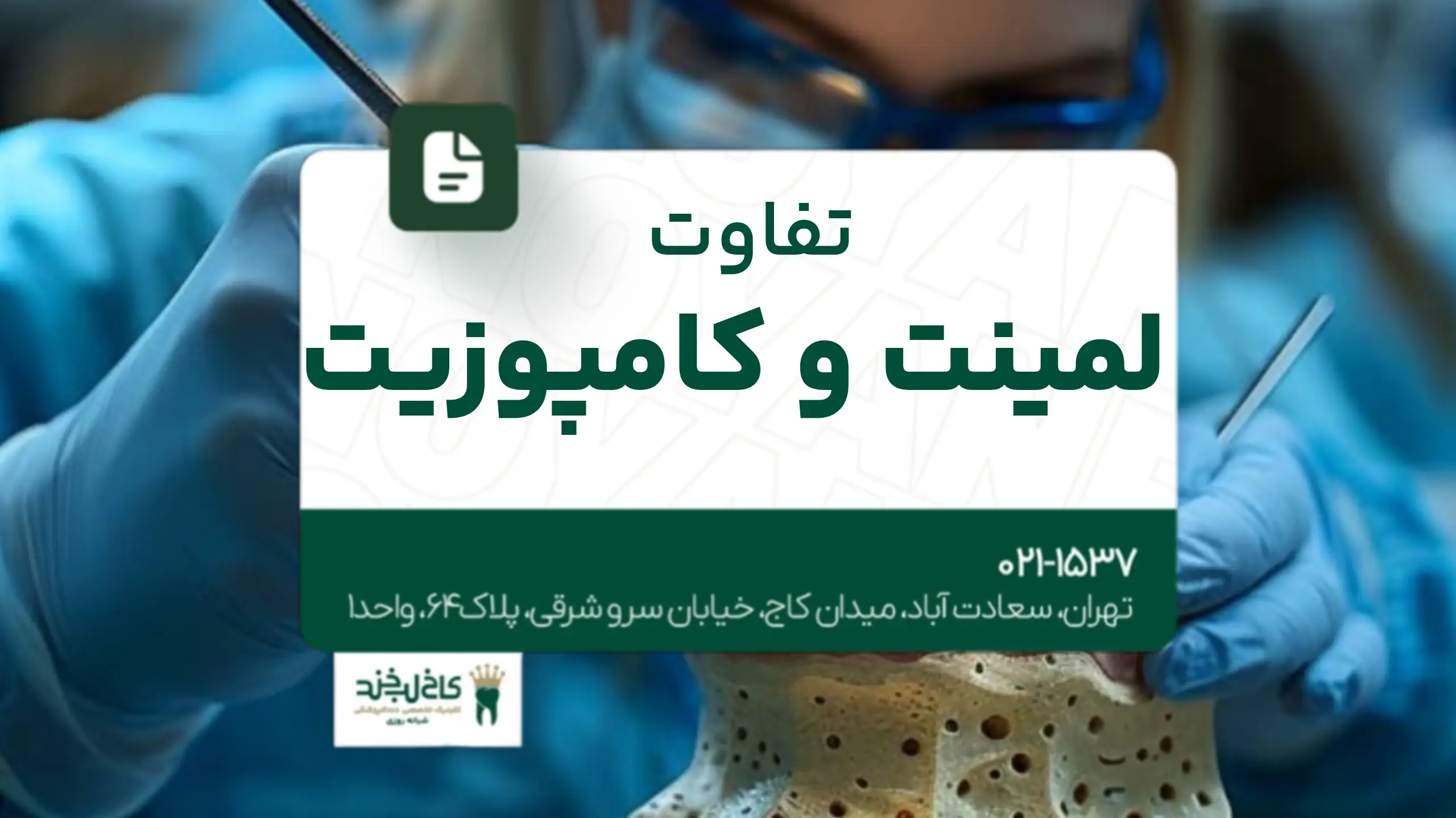 تفاوت لمینت و کامپوزیت