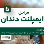 مراحل ایمپلنت دندان