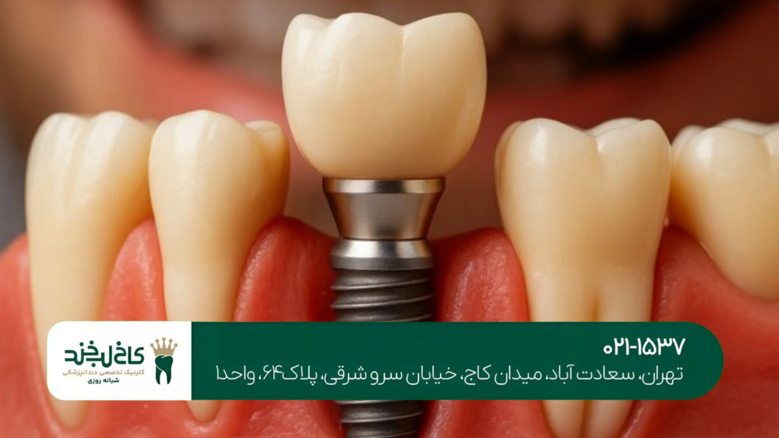 کلینیک دندانپزشکی غرب تهران