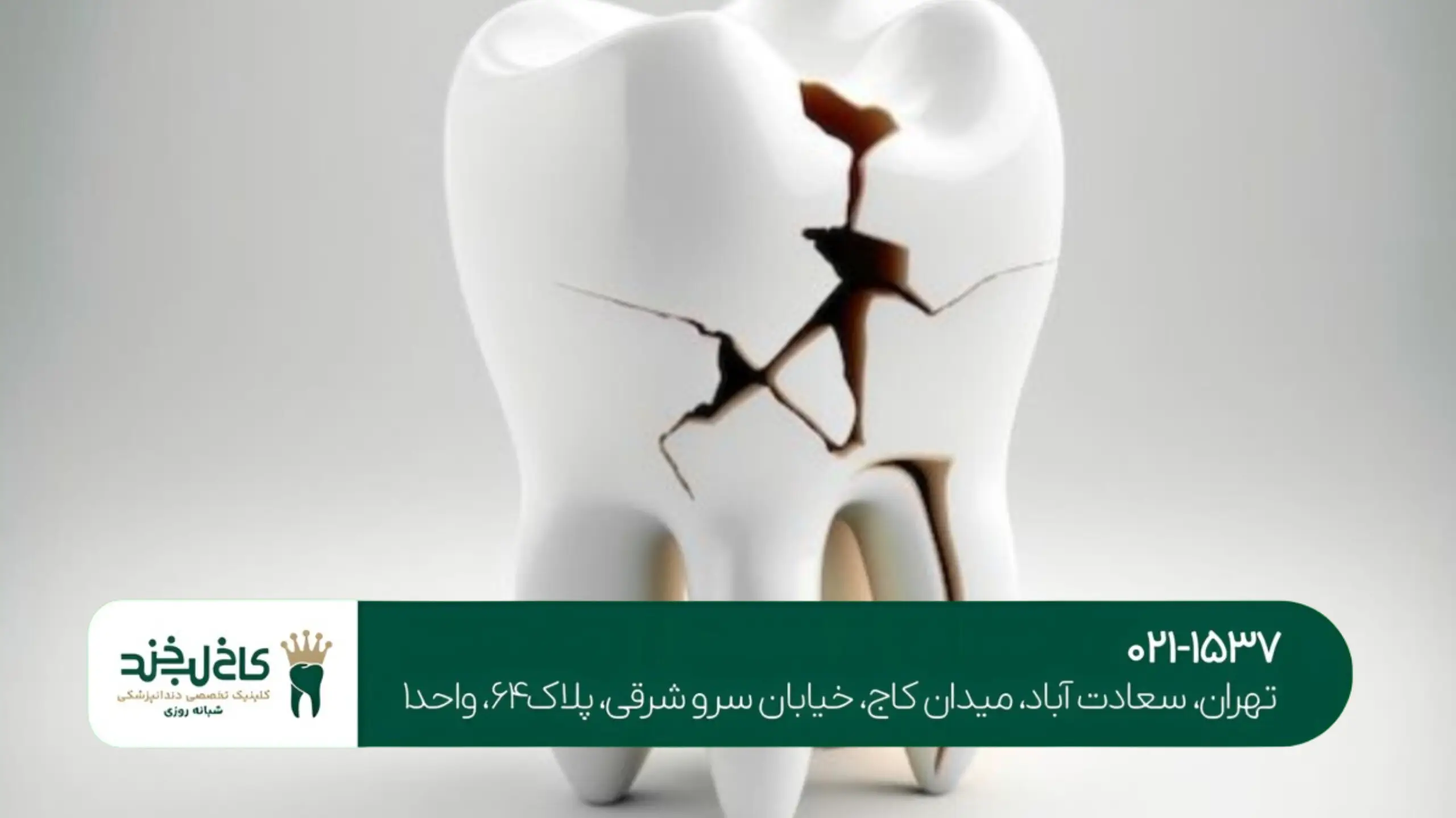 درمان تخصصی شکستگی دندان