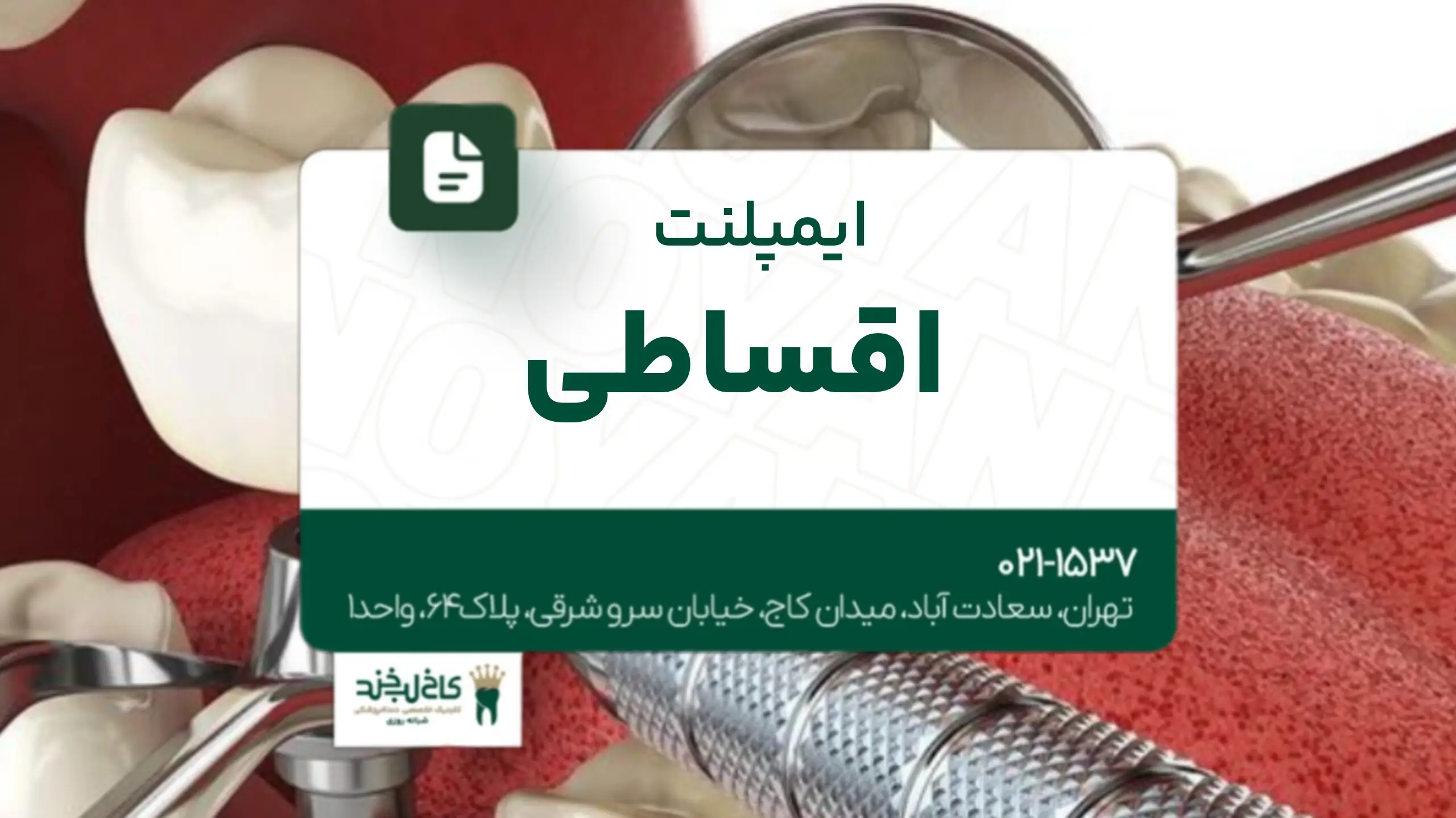 ایمپلنت اقساطی