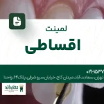 لمینت اقساطی