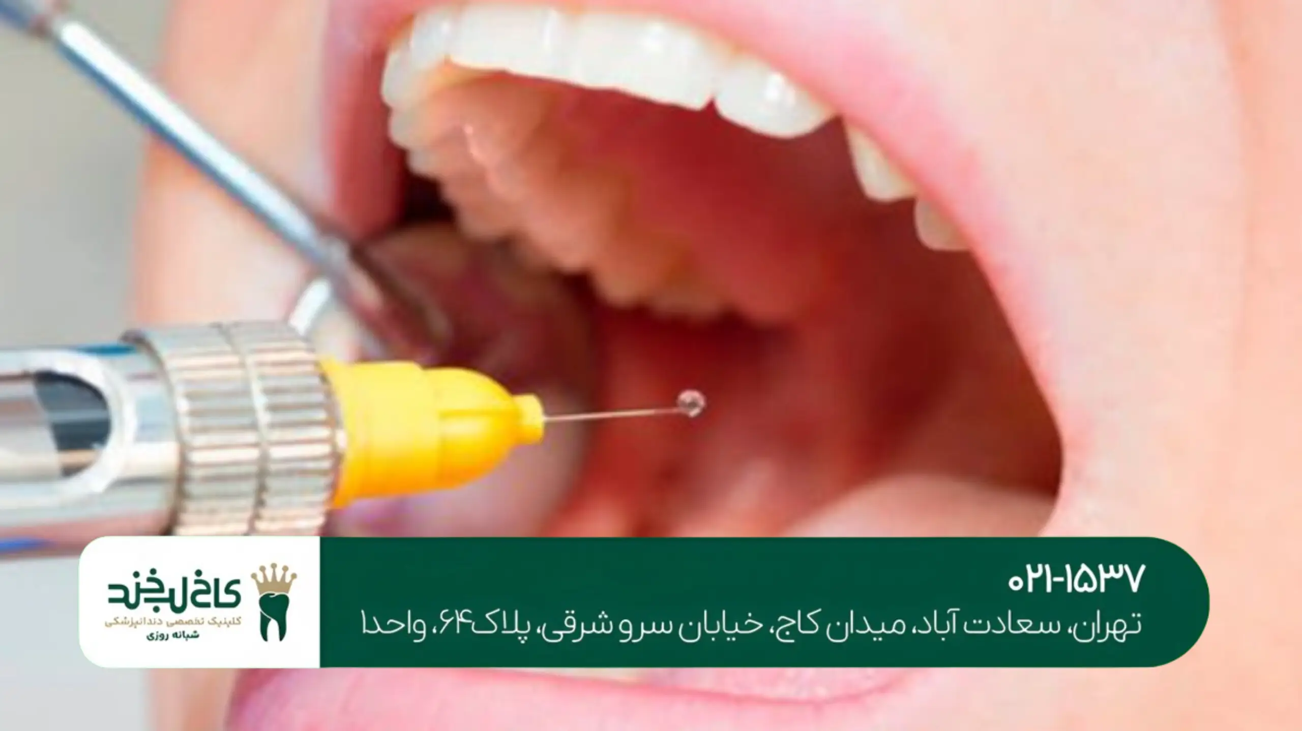 بهترین کلینیک ایمپلنت تهران