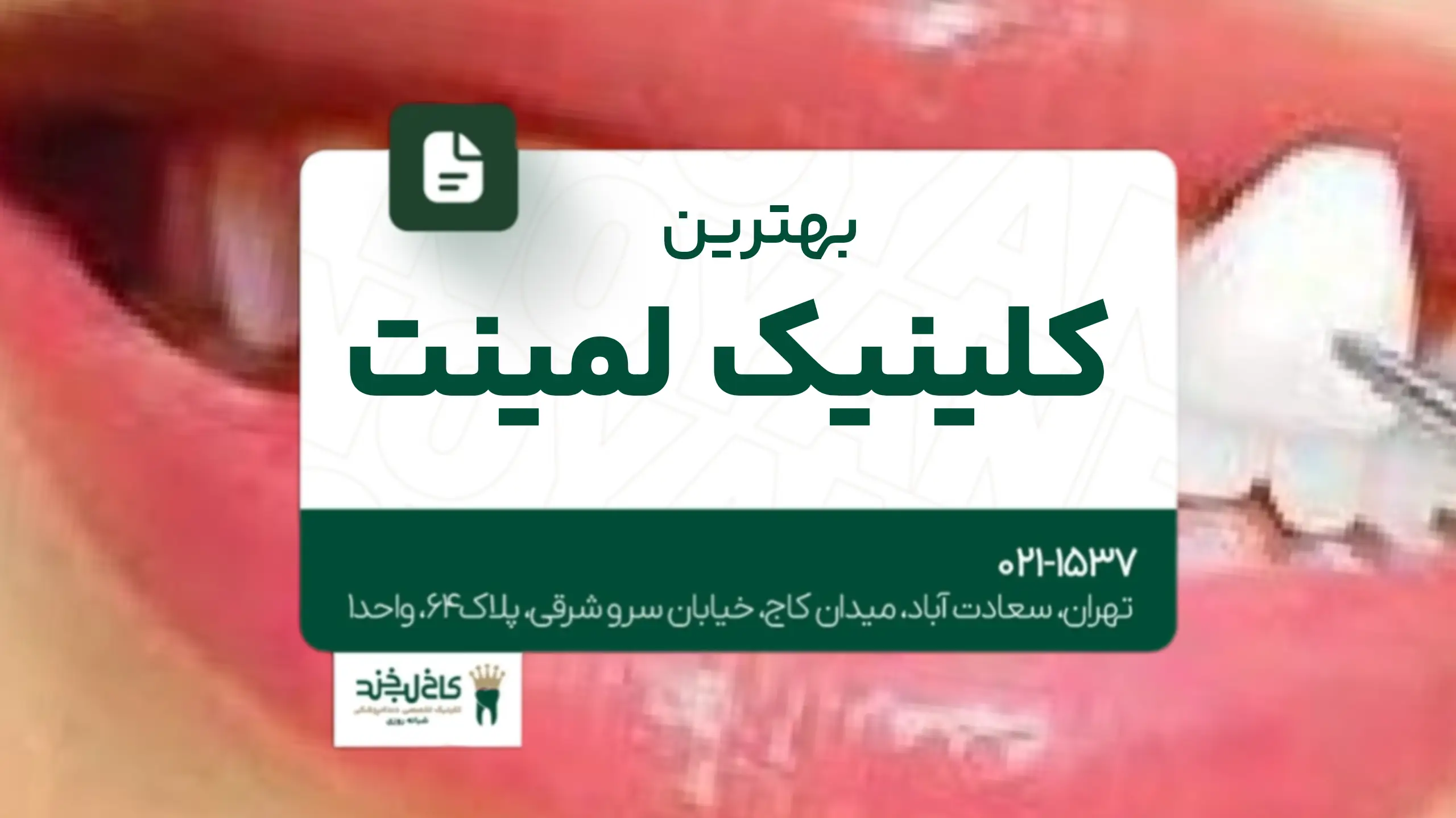 بهترین کلینیک لمینت