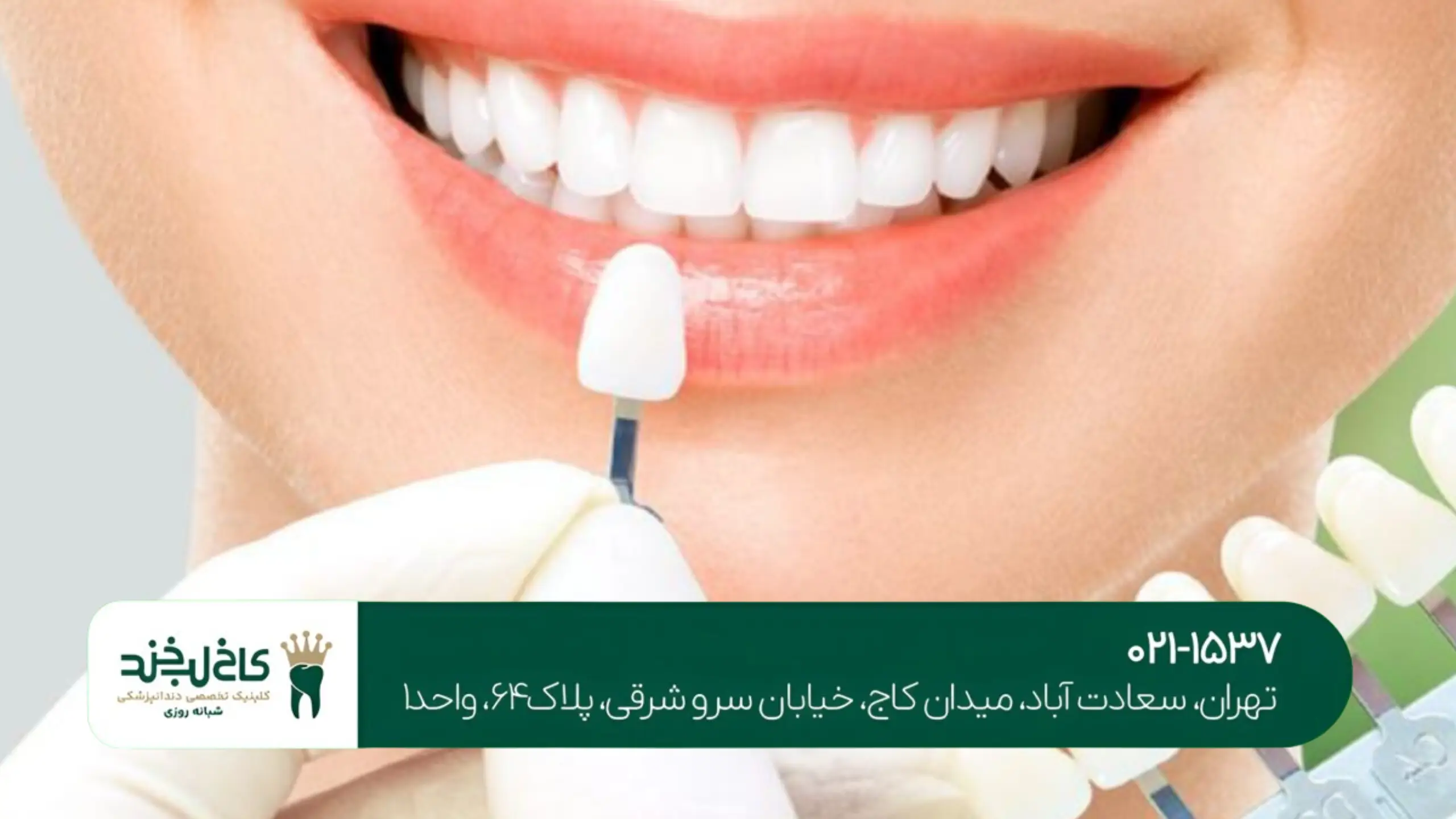 بهترین کلینیک لمینت