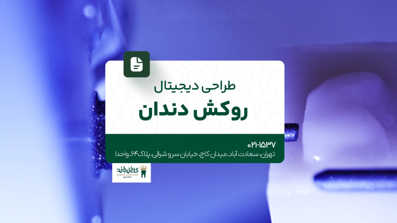 طراحی دیجیتال روکش دندان طراحی دیجیتال روکش دندان