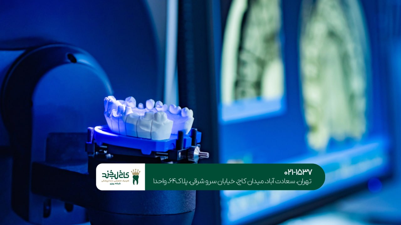 طراحی دیجیتال روکش دندان طراحی دیجیتال روکش دندان