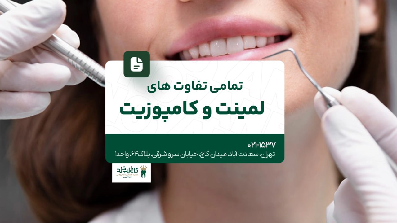 تمامی تفاوت های لمینت و کامپوزیت