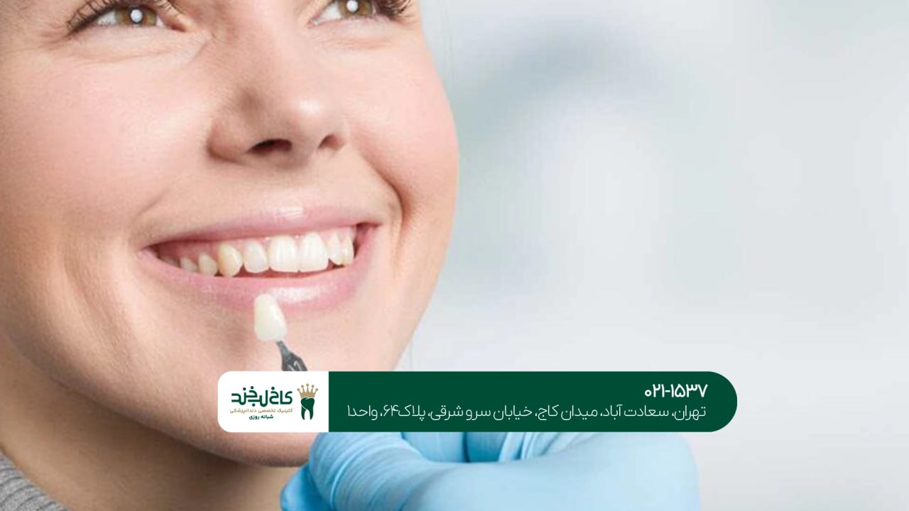 تمامی تفاوت های لمینت و کامپوزیت