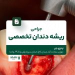 جراحی ریشه دندان تخصصی