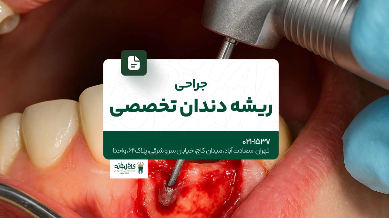 جراحی ریشه دندان تخصصی جراحی ریشه دندان تخصصی