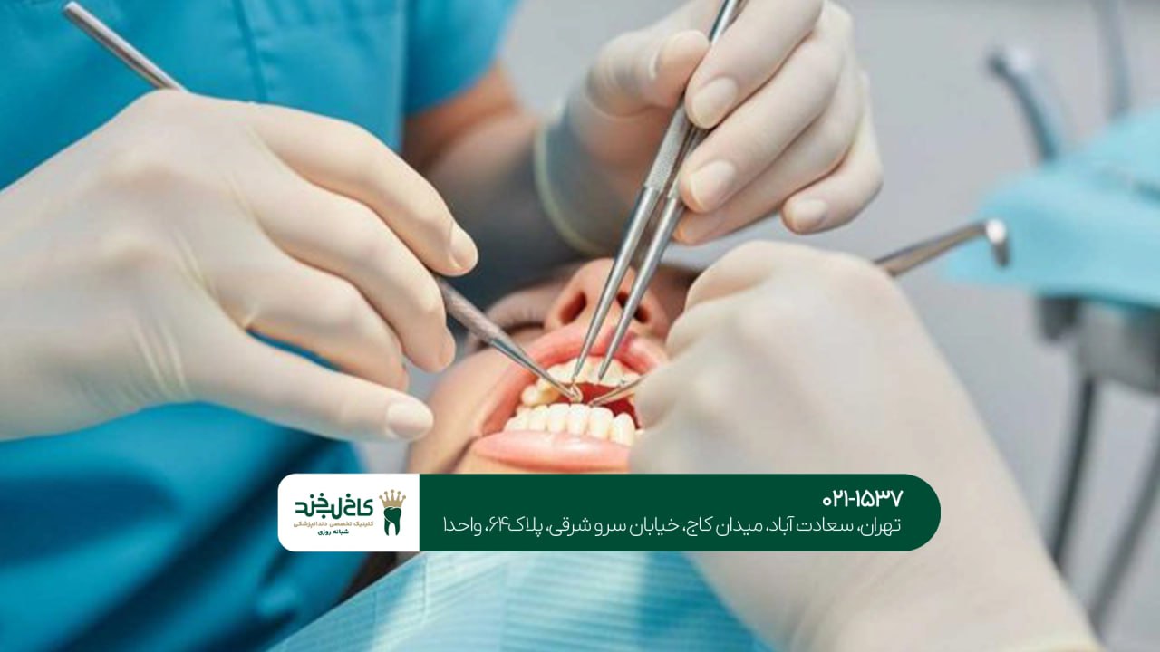جراحی ریشه دندان تخصصی جراحی ریشه دندان تخصصی