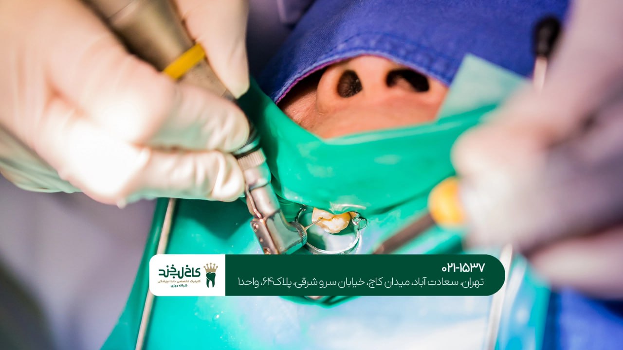 جراحی ریشه دندان تخصصی جراحی ریشه دندان تخصصی