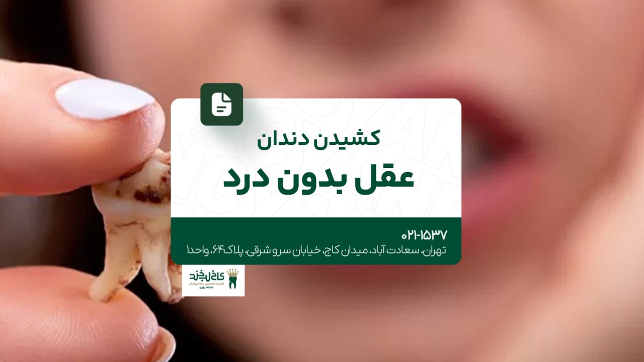 کشیدن دندان عقل بدون درد