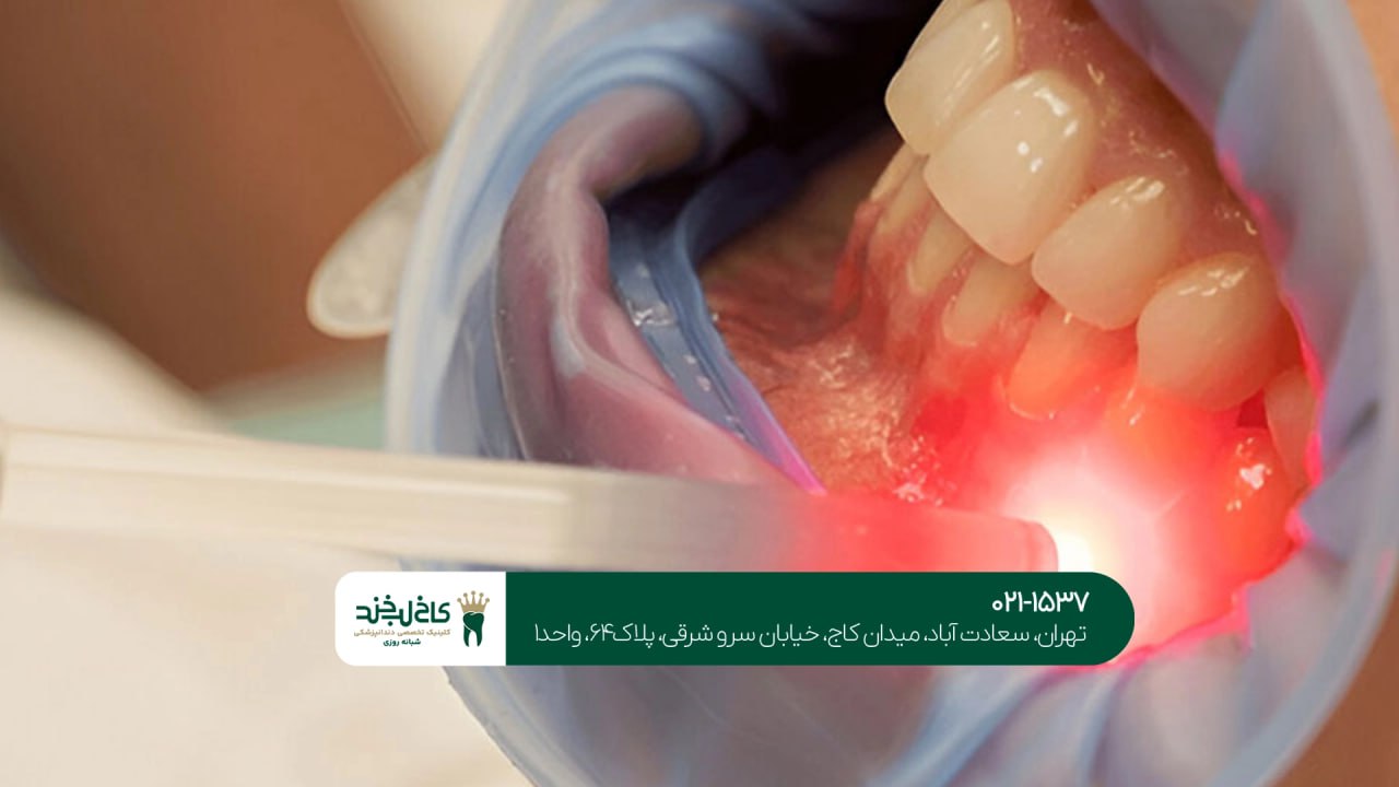 دندانپزشکی با فناوری لیزر دندانپزشکی با فناوری لیزر