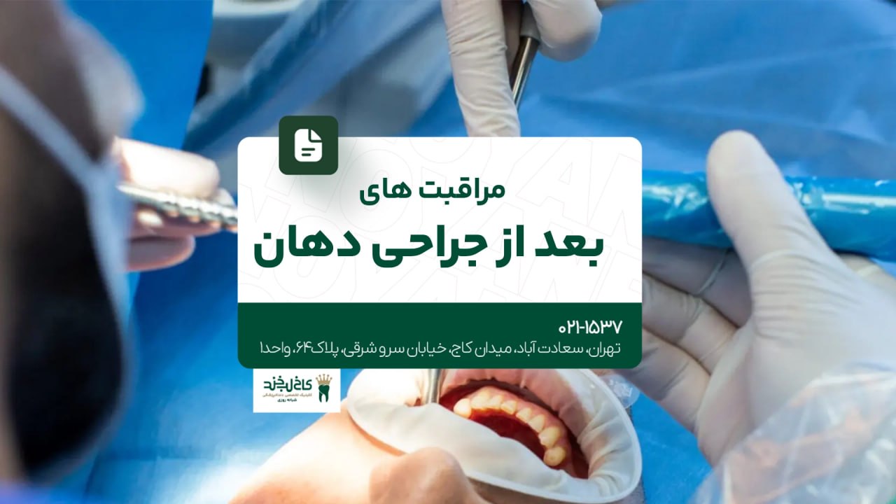 مراقبت های بعد از جراحی دهان