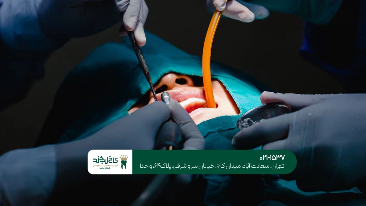 مراقبت های بعد از جراحی دهان