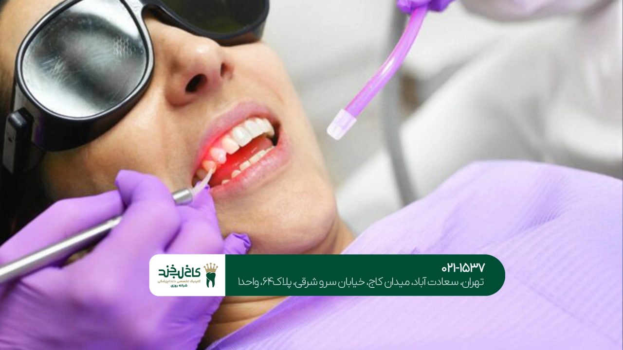 درمان لثه های تحلیل رفته با لیزر درمان لثه های تحلیل رفته با لیزر