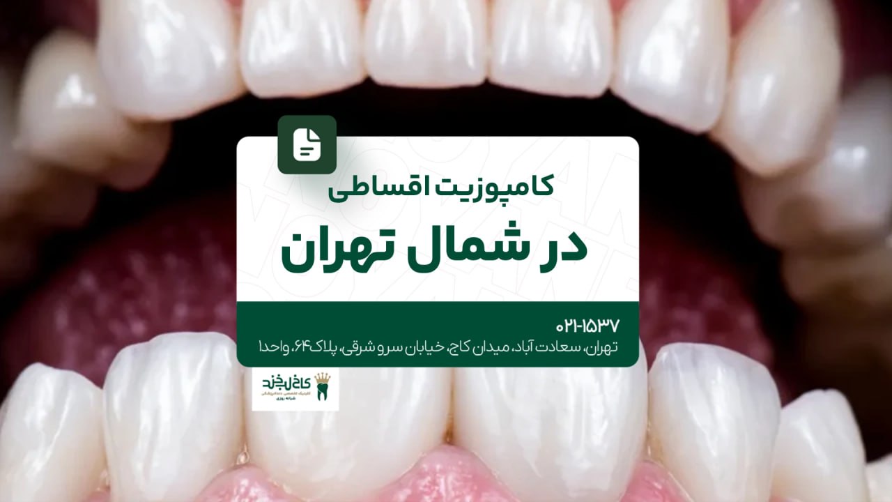 کامپوزیت اقساطی در شمال تهران کامپوزیت اقساطی در شمال تهران