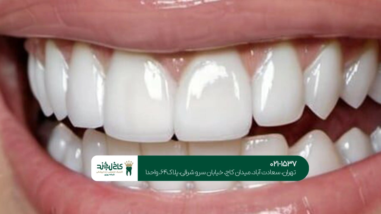 کامپوزیت اقساطی در شمال تهران