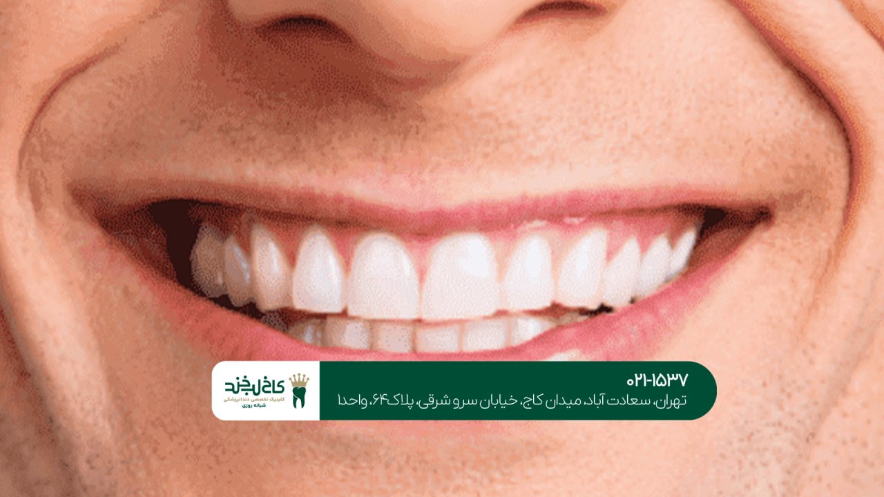 کامپوزیت اقساطی در شمال تهران کامپوزیت اقساطی در شمال تهران