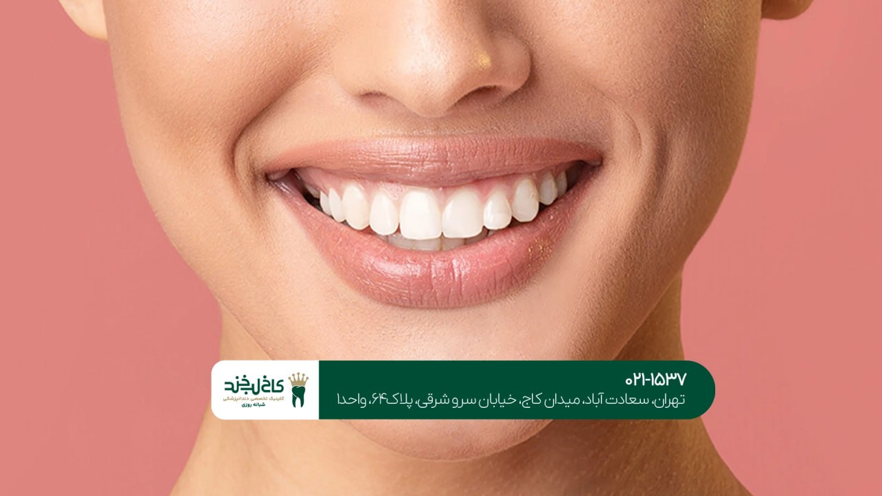 بهترین مرکز دندانپزشکی زیبایی در تهران بهترین مرکز دندانپزشکی زیبایی در تهران
