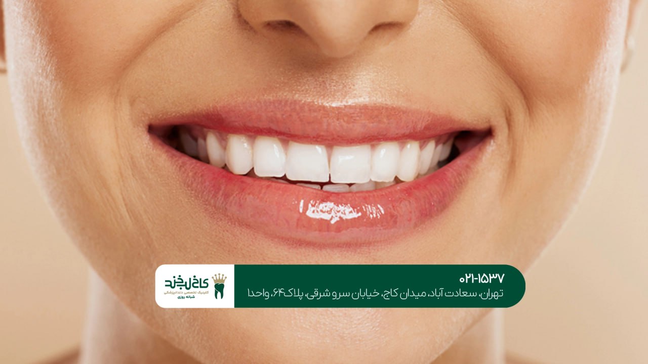 بهترین مرکز دندانپزشکی زیبایی در تهران بهترین مرکز دندانپزشکی زیبایی در تهران
