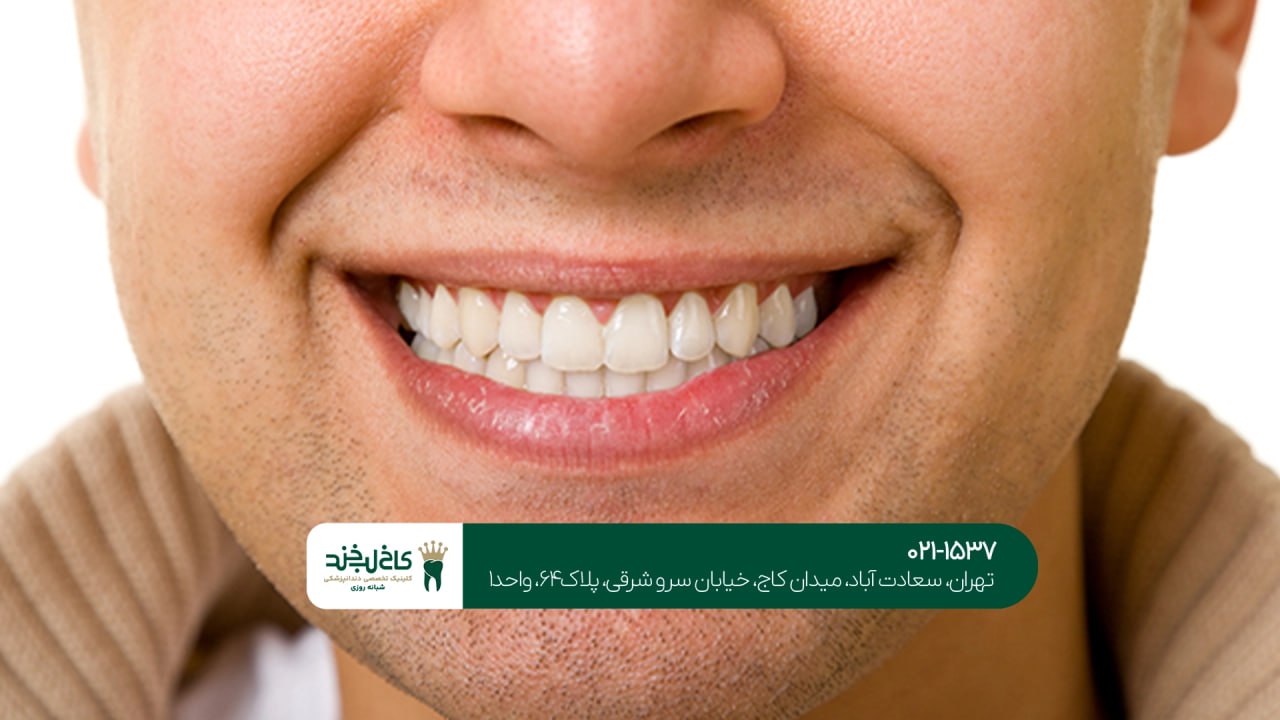 بهترین مرکز دندانپزشکی زیبایی در تهران بهترین مرکز دندانپزشکی زیبایی در تهران
