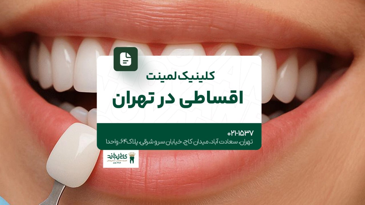 کلینیک لمینت اقساطی در تهران کلینیک لمینت اقساطی در تهران