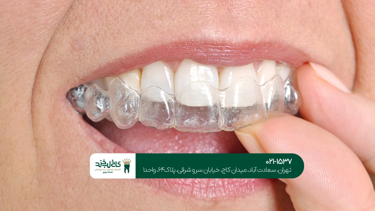 خدمات تخصصی دندانپزشکی زیبایی