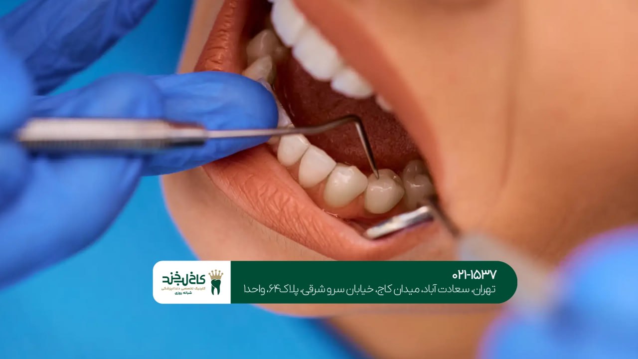 مرکز تخصصی درمان ریشه دندان