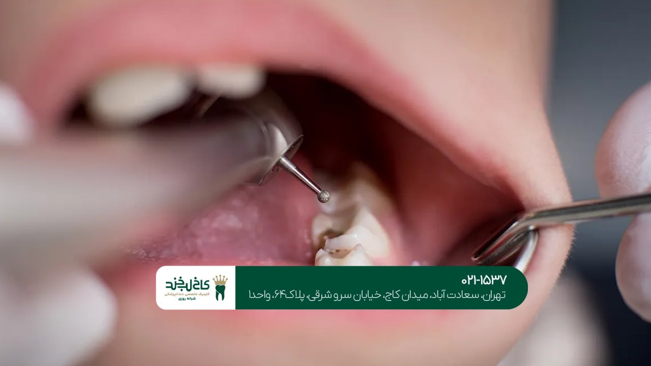 مرکز تخصصی درمان ریشه دندان