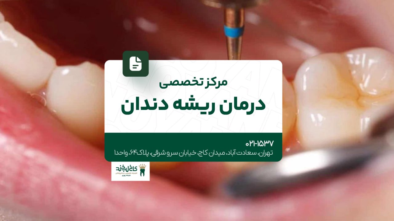 مرکز تخصصی درمان ریشه دندان