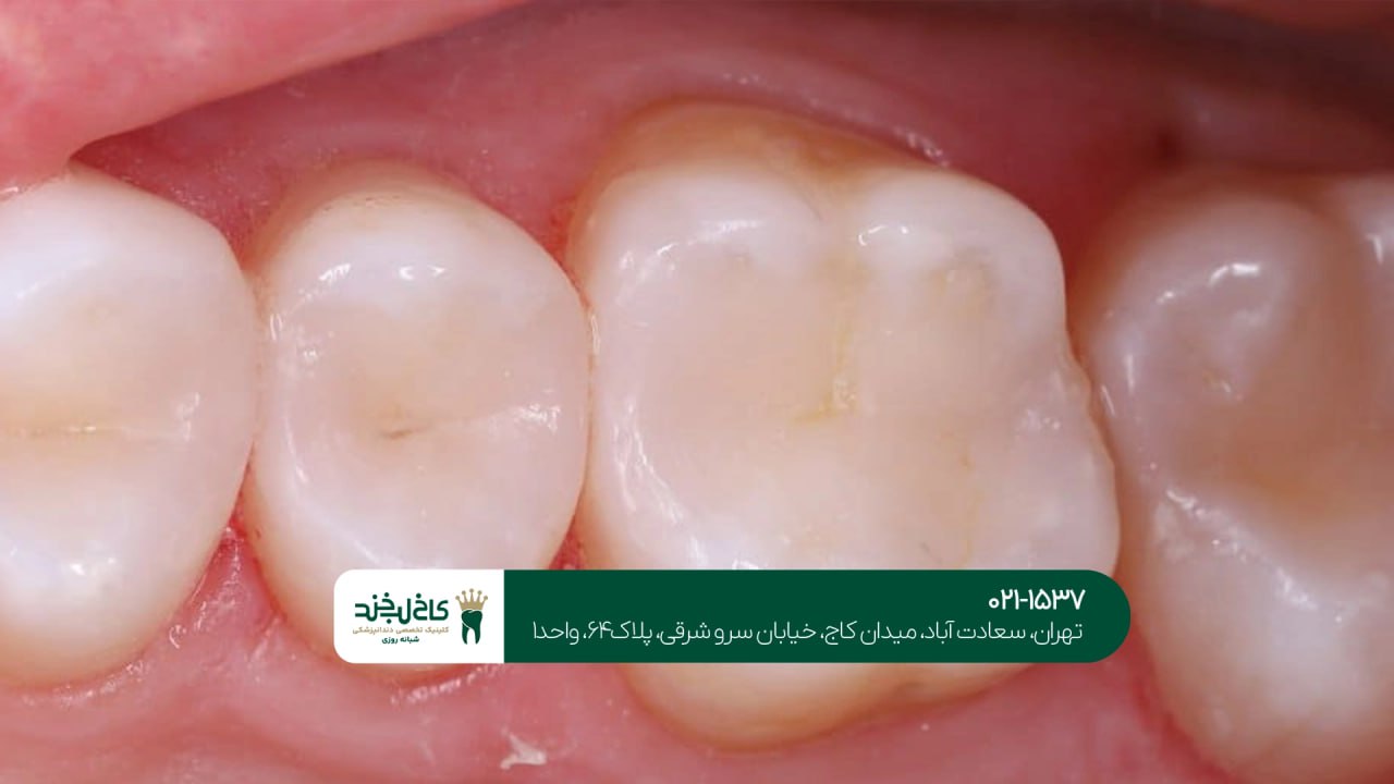 دندانپزشکی تخصصی ترمیم دندان