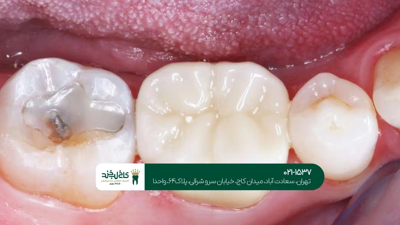 دندانپزشکی تخصصی ترمیم دندان