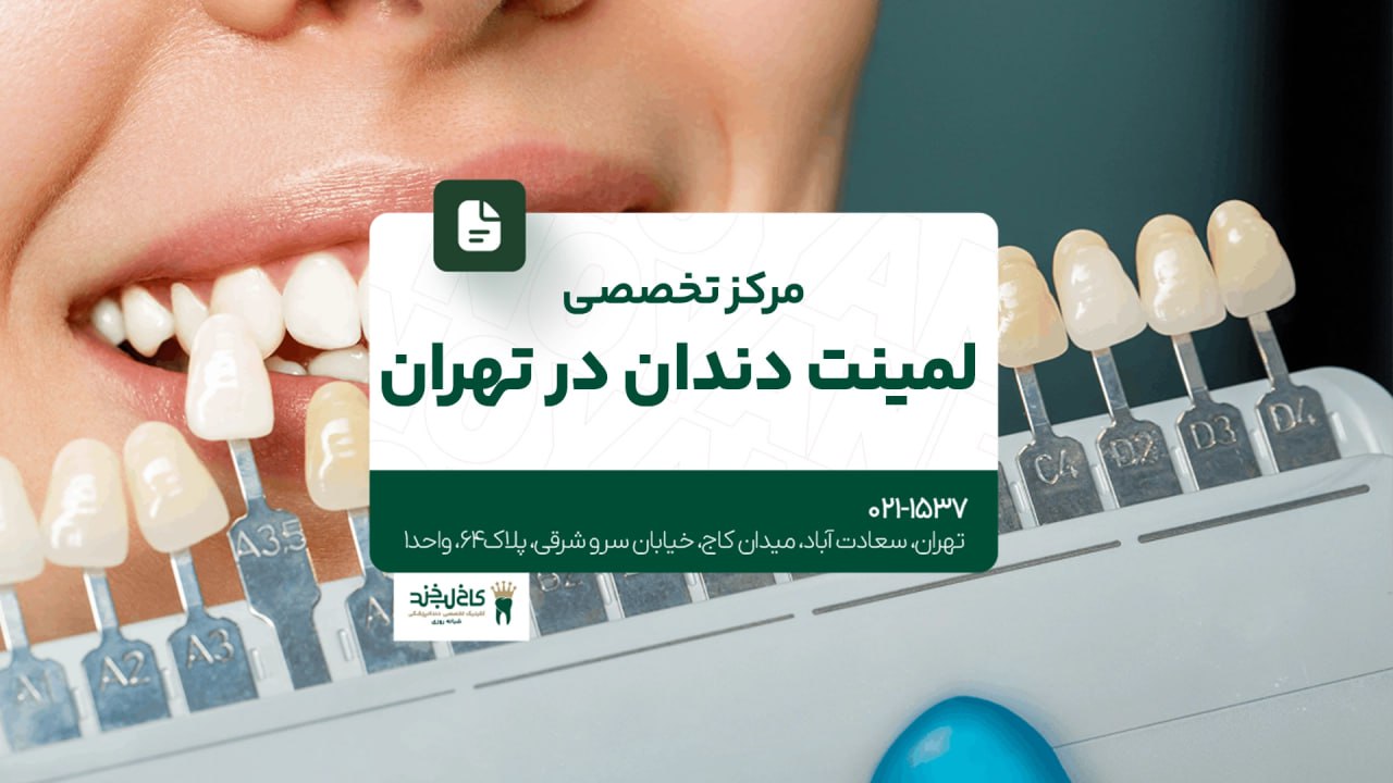 مرکز تخصصی لمینت دندان در تهران مرکز تخصصی لمینت دندان در تهران