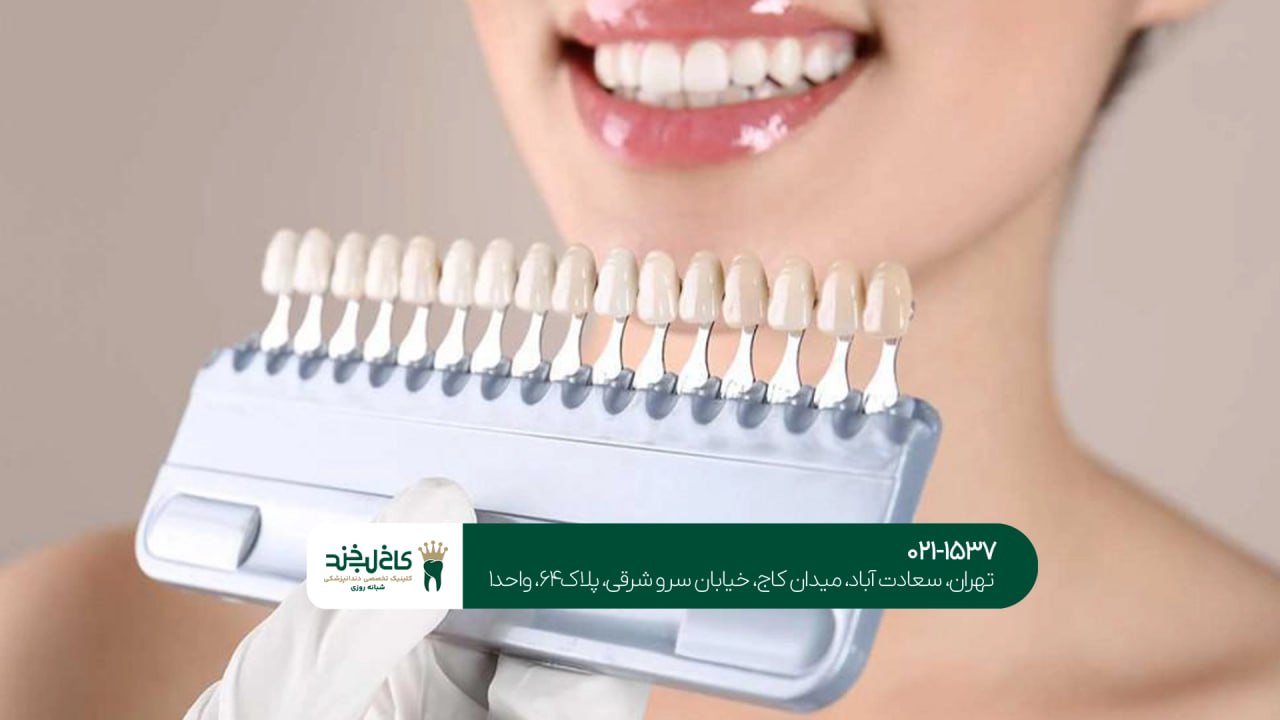 مرکز تخصصی لمینت دندان در تهران مرکز تخصصی لمینت دندان در تهران
