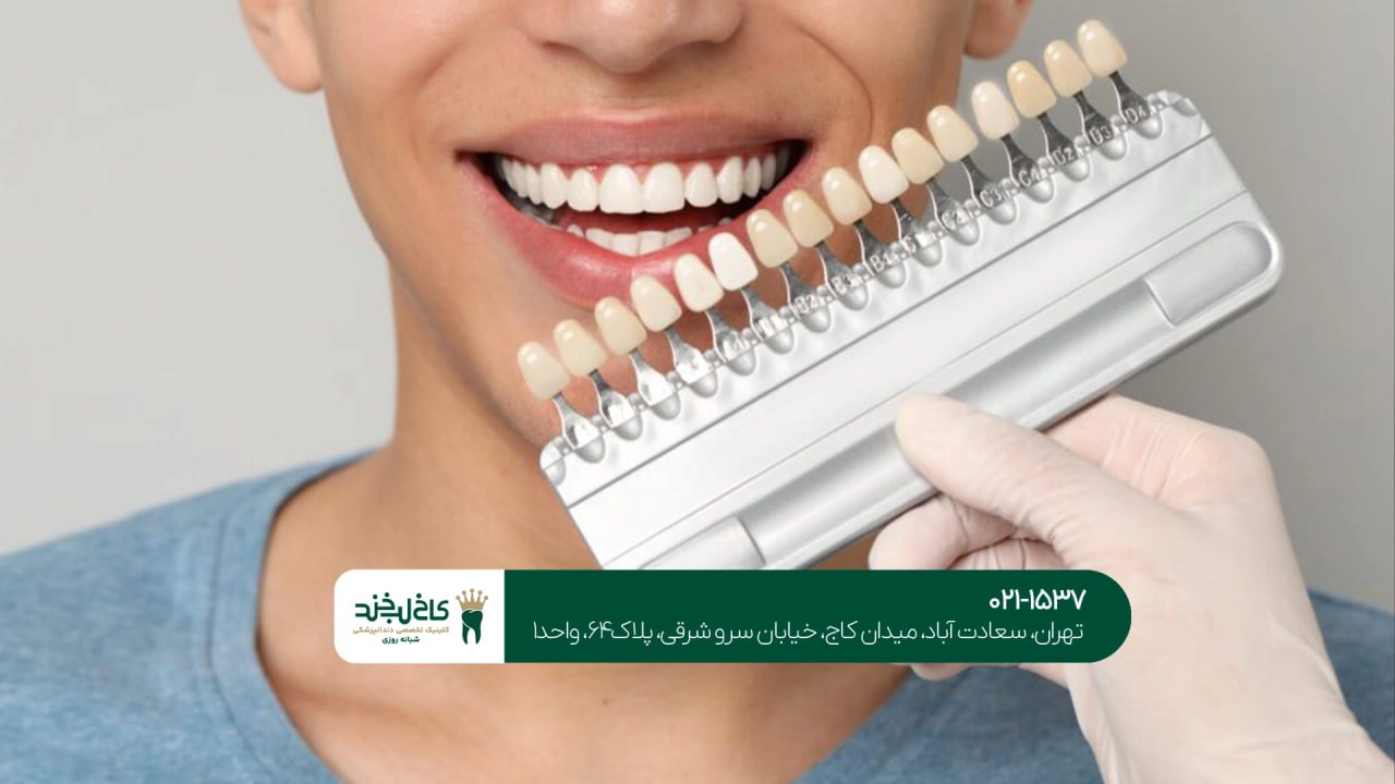 مرکز تخصصی لمینت دندان در تهران مرکز تخصصی لمینت دندان در تهران