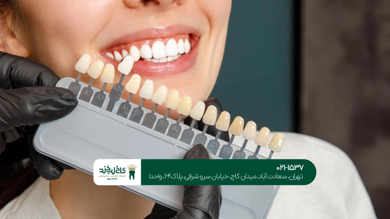 مرکز تخصصی لمینت دندان در تهران مرکز تخصصی لمینت دندان در تهران