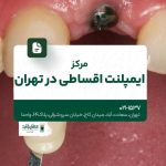 مرکز ایمپلنت اقساطی در تهران