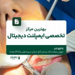 بهترین مرکز تخصصی ایمپلنت دیجیتال