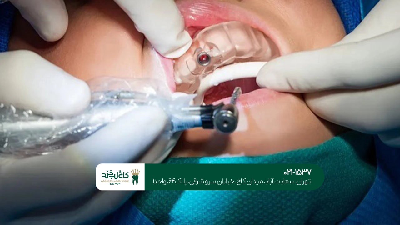 بهترین مرکز تخصصی ایمپلنت دیجیتال بهترین مرکز تخصصی ایمپلنت دیجیتال