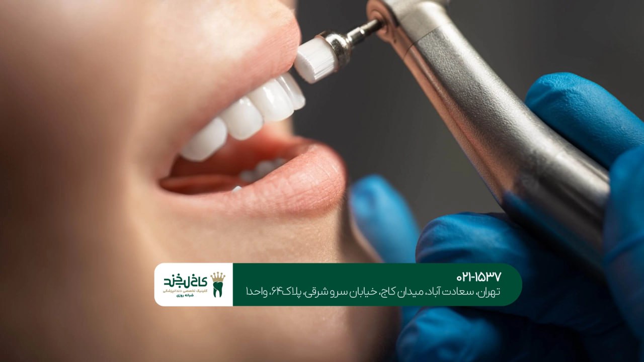 خدمات دندانپزشکی شبانه روزی اقساطی