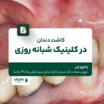 کاشت دندان در کلینیک شبانه روزی