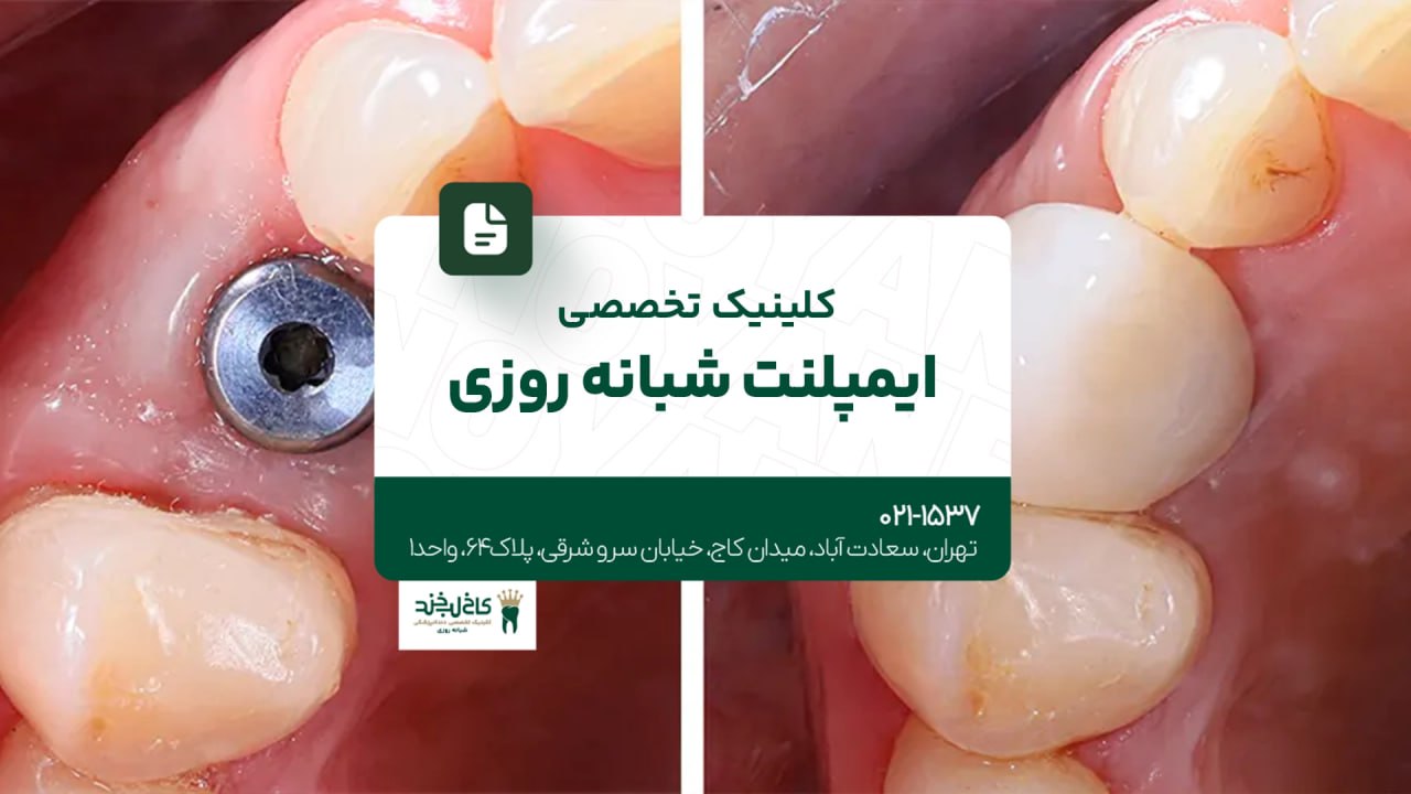 کلینیک تخصصی ایمپلنت شبانه روزی کلینیک تخصصی ایمپلنت شبانه روزی