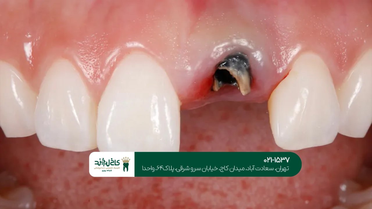 کلینیک تخصصی ایمپلنت شبانه روزی کلینیک تخصصی ایمپلنت شبانه روزی