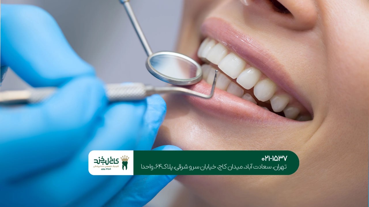 مرکز تخصصی جرم گیری و بلیچینگ مرکز تخصصی جرم گیری و بلیچینگ