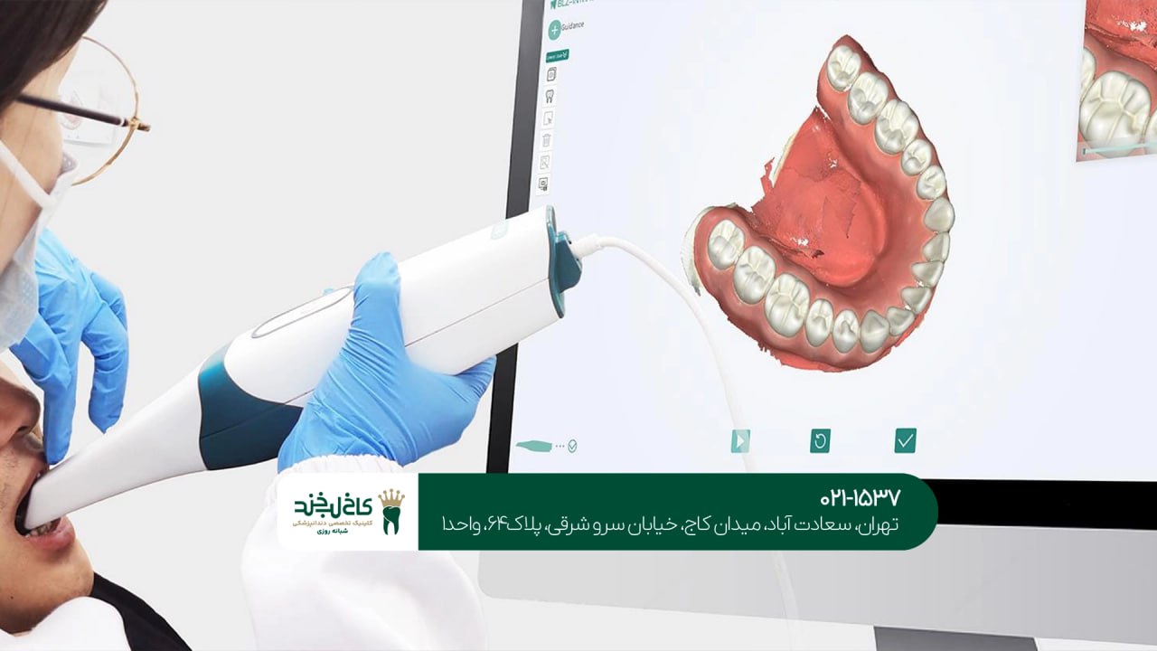 دندانپزشکی زیبایی با تجهیزات دیجیتال دندانپزشکی زیبایی با تجهیزات دیجیتال